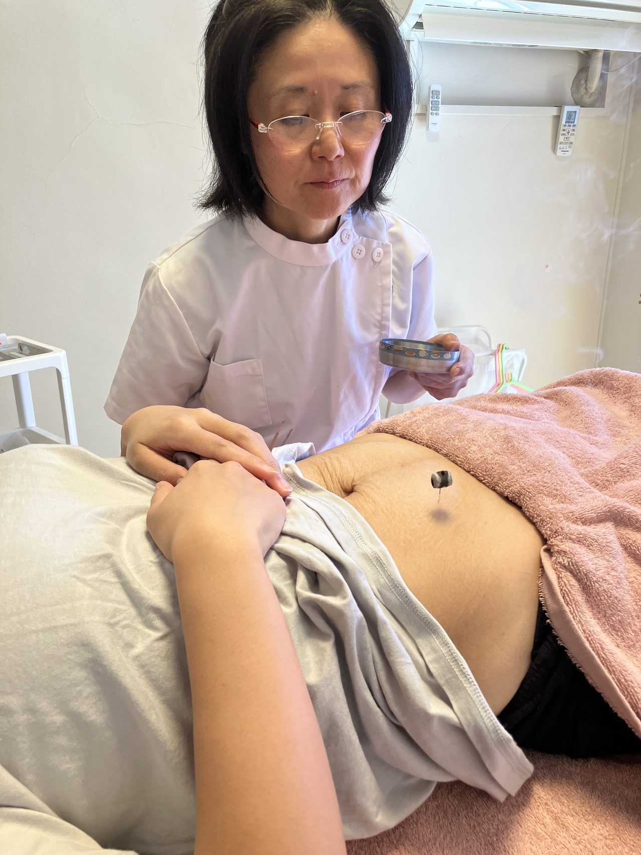 胃腸のお悩みに対するお灸の施術